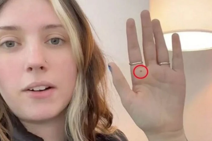 ChatGPT analysierte ein Foto der Hand einer Britin und gab einen unerwarteten Rat