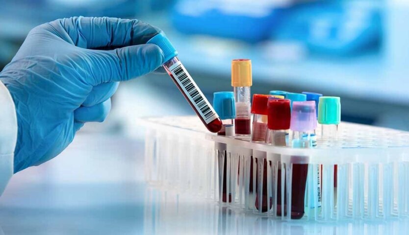 HIV, hepatitis, and tuberculosis can be controlled: Ukrainians are urged to take free testing